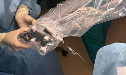 Prima implantare cohleară asistată robotic în România, realizată la Iași